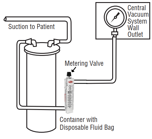 Aspirazione fluidi dai pazienti con ausilio di flussometro con valvola di aspirazione integrata